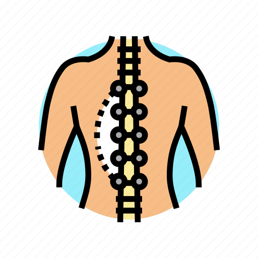 Scoliosis, surgery, hospital, health, surgical, room icon - Download on Iconfinder