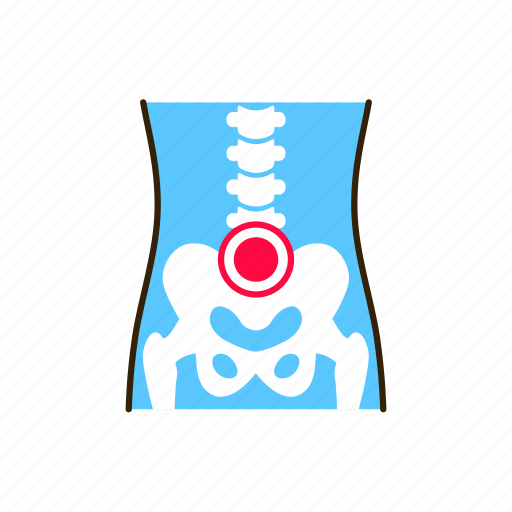 Arthritis, body, human, inflammation, joints, lower back icon - Download on Iconfinder