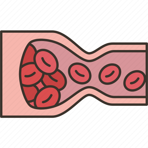 Blood, clot, arteriosclerosis, vein, disease icon - Download on Iconfinder
