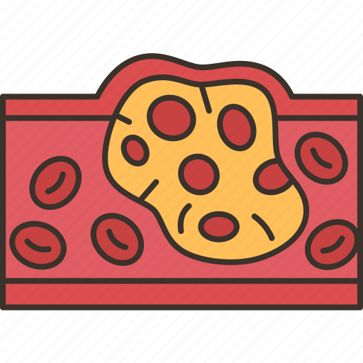Cholesterol, blood, atherosclerosis, artery, blocked icon - Download on Iconfinder