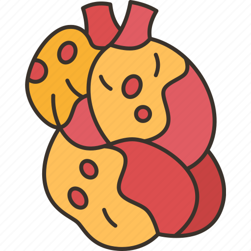 Hyperlipidemia, cholesterol, artery, cardiovascular, health icon - Download on Iconfinder