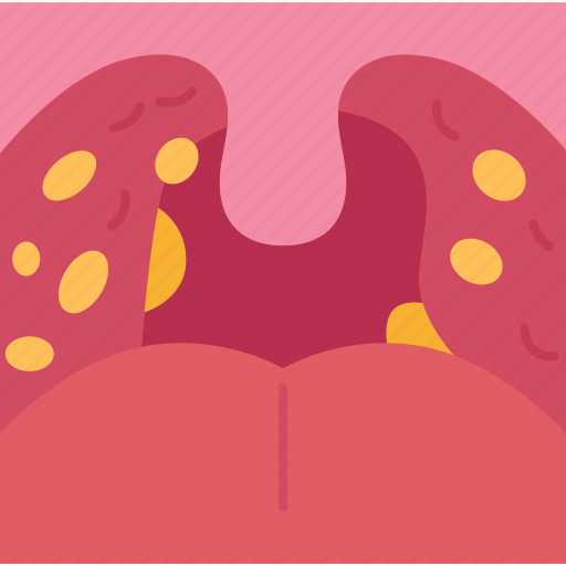 Tonsil, stone, throat, bad, breath icon - Download on Iconfinder