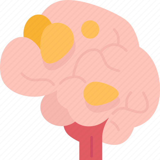 Brain, cancer, tumor, neurology, medical icon - Download on Iconfinder
