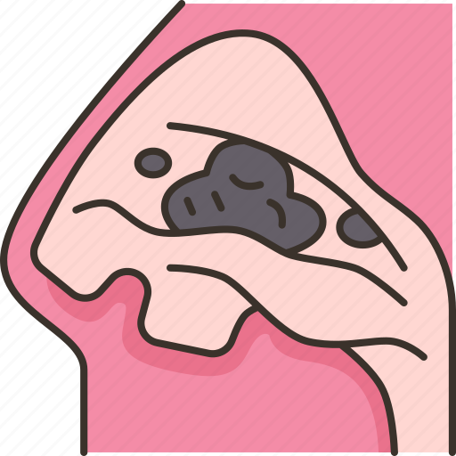 Sinus, cancer, nasopharyngeal, nasal, disease icon - Download on Iconfinder