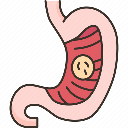 Stomach, cancer, gastric, adenocarcinoma, digestive icon - Download on Iconfinder