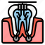 endodontics, root canal, teeth, dentistry, treatment 
