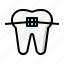 orthodontics, dental, braces, dentist, healthcare 