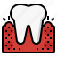 swollen gums, gum, dental, periodontal disease, inflammation 