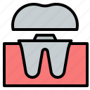 dental, crown, teeth, tooth, dentist