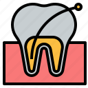 tooth, root, canal, odontology, dental, teeth, dentist
