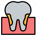decayed, dental, teeth, tooth, dentist
