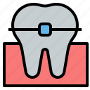 braces, orthodontic, dentistry, dental, teeth, tooth, dentist