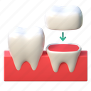 tooth, crown, implant, illustration, 3d cartoon, isolated, healthcare, teeth, clean 