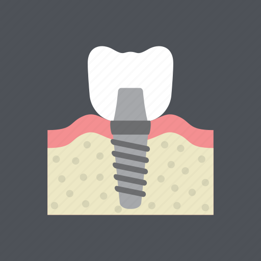 Dental, dentist, health, implant, medical, molar, tooth icon - Download on Iconfinder