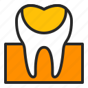 cavity, decay, dentistry, filling, healthcare, orthodontics, tooth