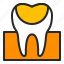 cavity, decay, dentistry, filling, healthcare, orthodontics, tooth 