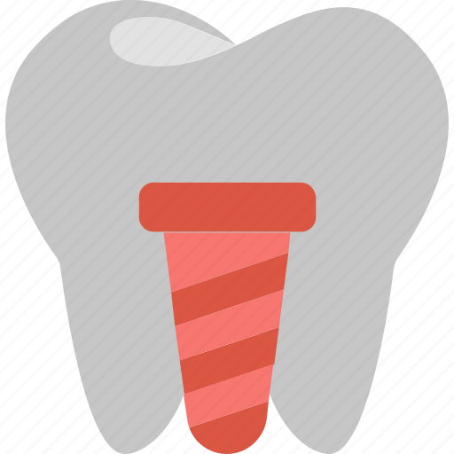 Dental, prosthetics, dentistry, fixture, healthcare, implant, tooth icon - Download on Iconfinder