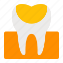 cavity, decay, dentistry, filling, oral, orthodontics, tooth