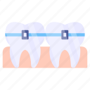 dental braces, tooth braces, stomatology, dentistry, orthodontist