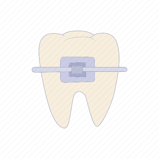 Brace, cartoon, dental, female, lips, mouth, person icon - Download on Iconfinder
