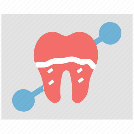 Dental care, dental disease, dental filling, dental pain, protection, tooth disease icon - Download on Iconfinder