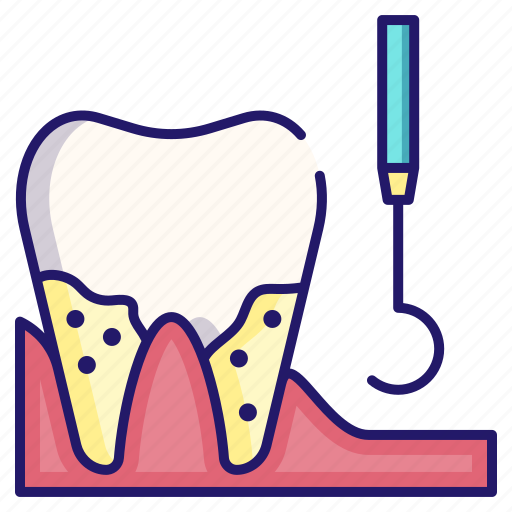 Cleaning, dental, healthcare, plaque, tartar, tooth icon - Download on Iconfinder