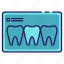 dental, dentistry, medical, mouth, teeth, teeth x-ray, x-ray 