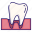 dental, dentistry, loose, medical, tooth, tooth loose 