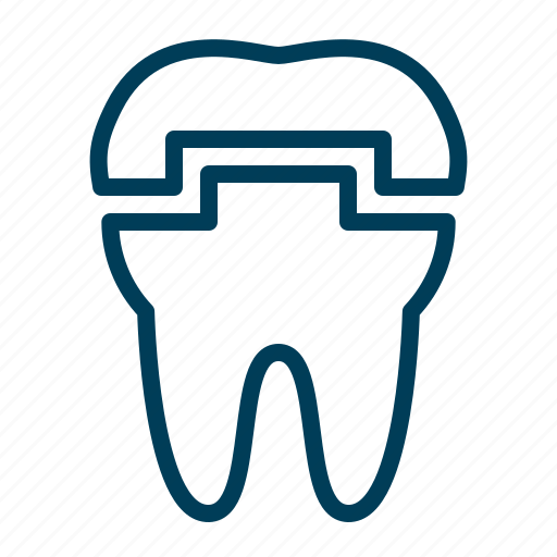 Crown, dental, dentist, install, tooth icon - Download on Iconfinder