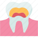 enamel, tooth, dental, care, oral