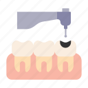 cavity, handpeace, tooth, dentist