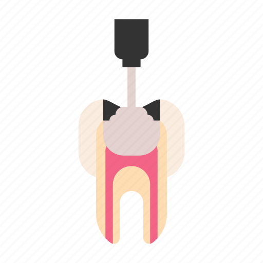 Fill, tooth, dental, dentist icon - Download on Iconfinder