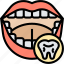caries, decay, tooth, problem, oral 