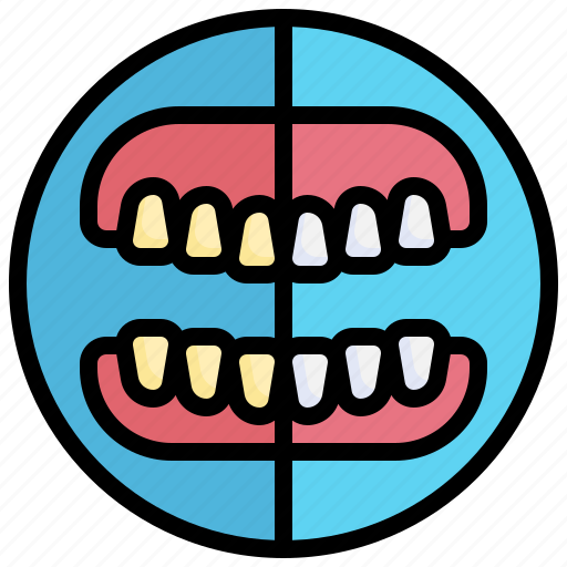 Teeth, whitening, dental, tooth, care, treatment, protect icon - Download on Iconfinder