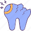 dental, tooth, teeth, crack, broken tooth 