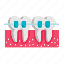 teeth, tooth, braces, dental, stomatology, cases