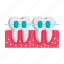 teeth, tooth, braces, dental, stomatology, cases 