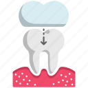 dental treatment, tooth cap, crown, dentistry, new teeth, replacment, plastic tooth