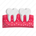 pulp cavity, teeth, tooth, dental, dentistry, care