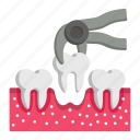 teeth pulling, teeth extraction, forceps, plier, tooth, healthcare