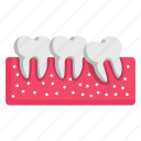 tooth, slipping, crown, teeth, misplaced, medical