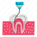 teeth, tooth, root canal, surgery, treatment, injection, endodontic therapy