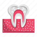 tooth, teeth, root canal, anatomy, dentistry, dental
