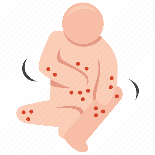 Allergic, allergy, rash, reaction, skin, symptom icon - Download on Iconfinder