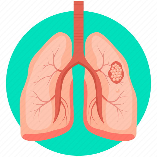 Disease, lungs, lungs cancer, lungs disease, lungs infection, virus icon - Download on Iconfinder
