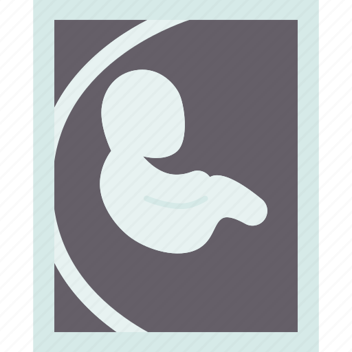 Ultrasound, scan, baby, fetus, pregnancy icon - Download on Iconfinder