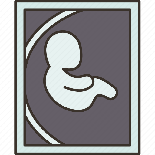 Ultrasound, scan, baby, fetus, pregnancy icon - Download on Iconfinder