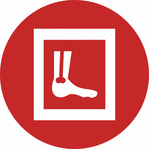 Bones, foot, joint, ray, x icon - Download on Iconfinder