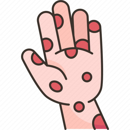 Rash, skin, aids, infection, diseases icon - Download on Iconfinder