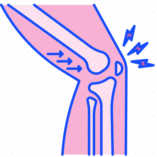 Dislocated, knee, bone, joint, bones, osteoarthritis icon - Download on Iconfinder
